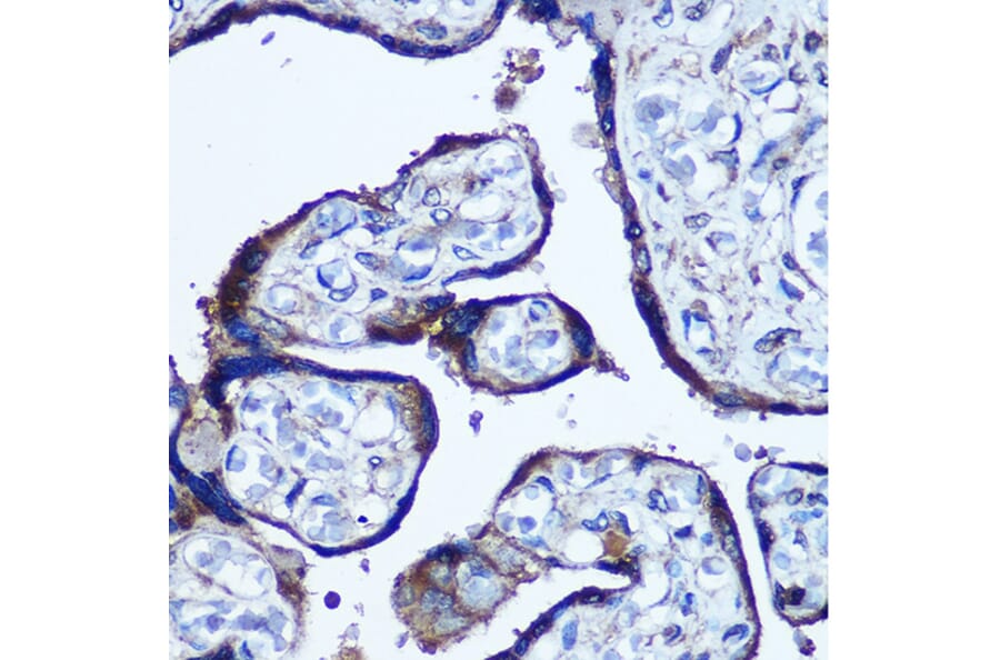 Immunohistochemistry - Anti-TBCCD1 Antibody (A306754) - Antibodies.com