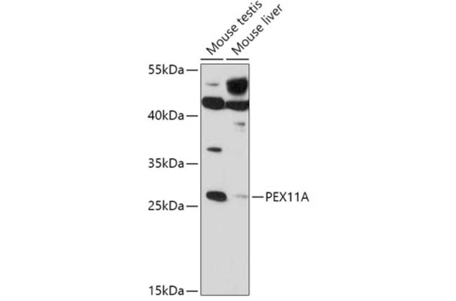 Western Blot - Anti-PEX11A Antibody (A306755) - Antibodies.com