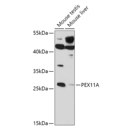Western Blot - Anti-PEX11A Antibody (A306755) - Antibodies.com