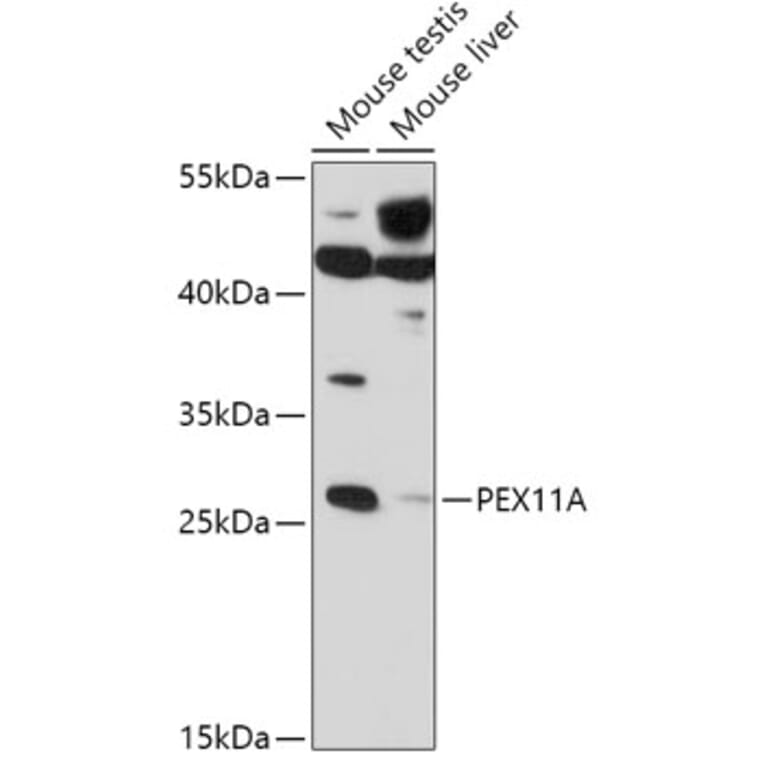 Western Blot - Anti-PEX11A Antibody (A306755) - Antibodies.com