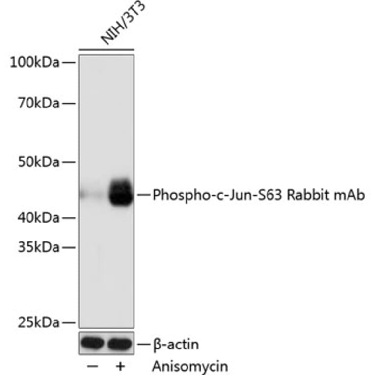 Western Blot - Anti-c-Jun (phospho Ser63) Antibody [ARC0051] (A306756) - Antibodies.com