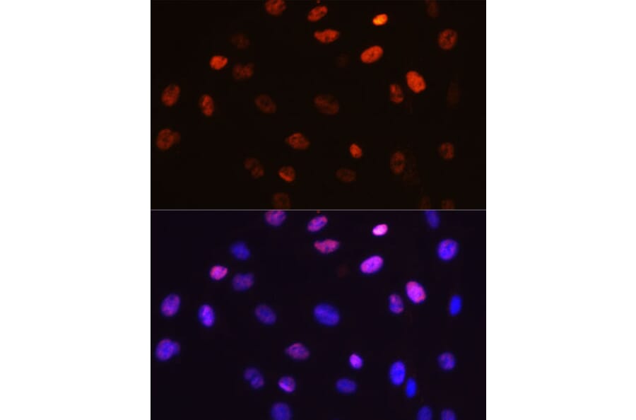 Immunofluorescence - Anti-c-Jun (phospho Ser63) Antibody [ARC0051] (A306756) - Antibodies.com