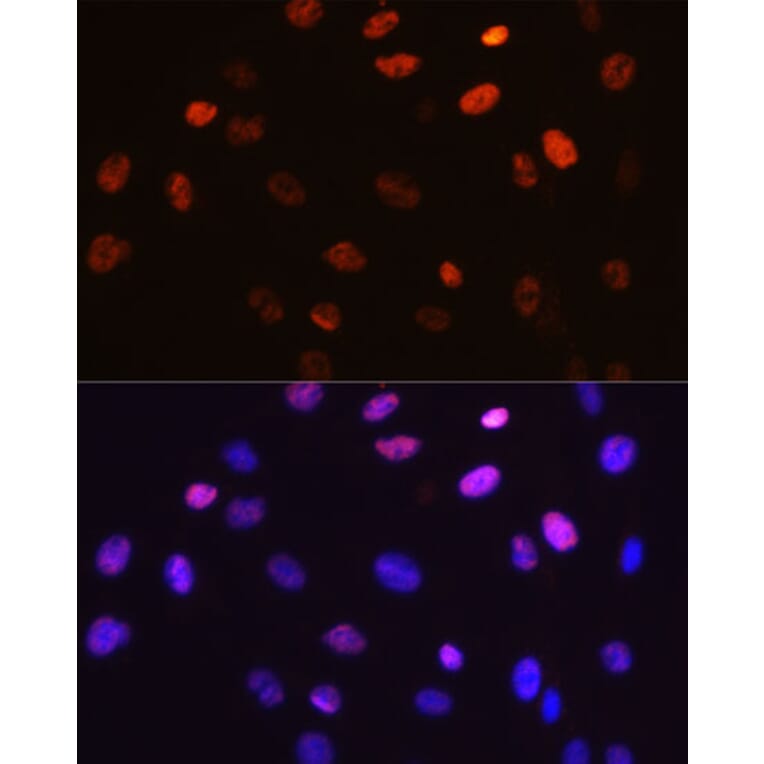 Immunofluorescence - Anti-c-Jun (phospho Ser63) Antibody [ARC0051] (A306756) - Antibodies.com