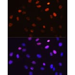 Immunofluorescence - Anti-c-Jun (phospho Ser63) Antibody [ARC0051] (A306756) - Antibodies.com