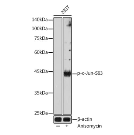 Western Blot - Anti-c-Jun (phospho Ser63) Antibody (A306757) - Antibodies.com
