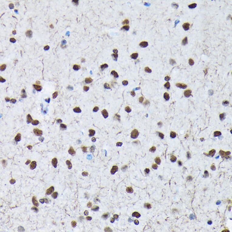 Immunohistochemistry - Anti-c-Jun (phospho Ser63) Antibody (A306757) - Antibodies.com