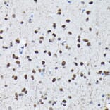 Immunohistochemistry - Anti-c-Jun (phospho Ser63) Antibody (A306757) - Antibodies.com