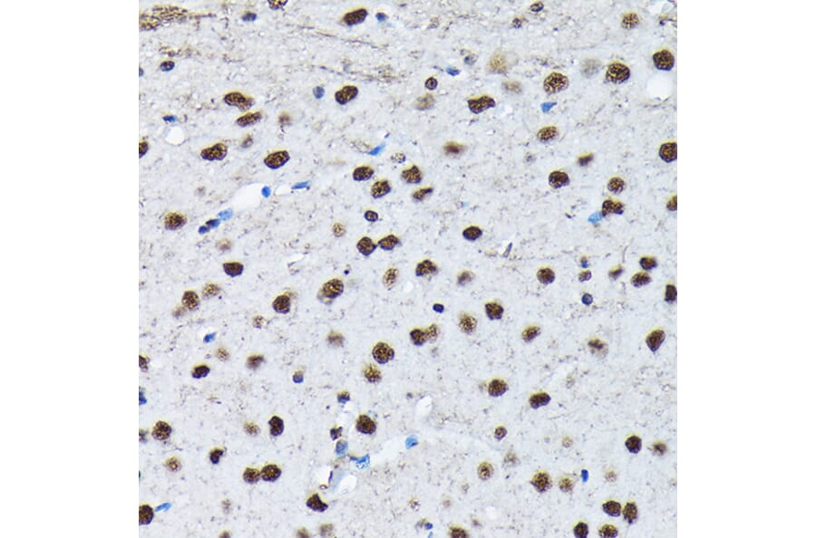 Immunohistochemistry - Anti-c-Jun (phospho Ser63) Antibody (A306757) - Antibodies.com