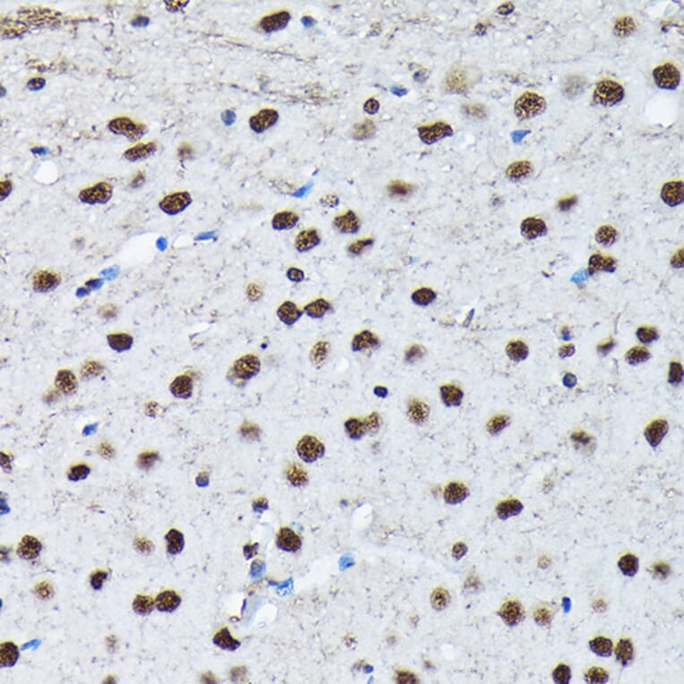 Immunohistochemistry - Anti-c-Jun (phospho Ser63) Antibody (A306757) - Antibodies.com