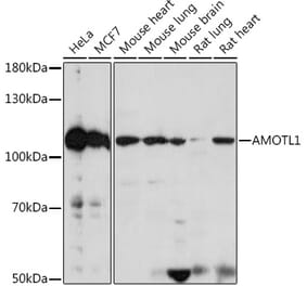 Western Blot - Anti-Angiomotin like 1 Antibody (A306758) - Antibodies.com