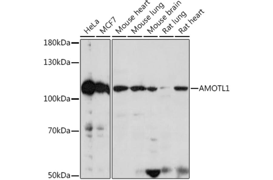 Western Blot - Anti-Angiomotin like 1 Antibody (A306758) - Antibodies.com