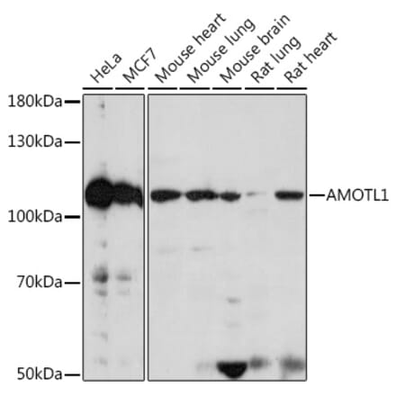 Western Blot - Anti-Angiomotin like 1 Antibody (A306758) - Antibodies.com