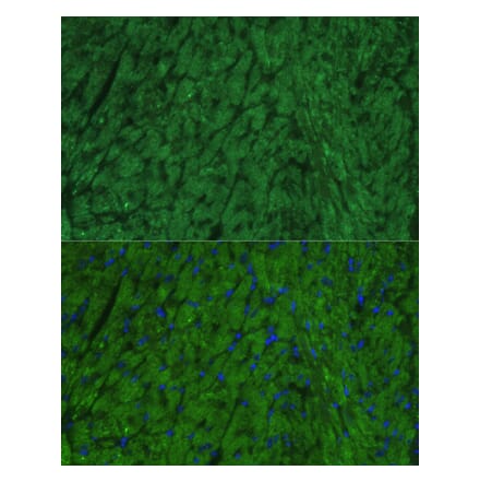 Immunofluorescence - Anti-Natriuretic peptides A Antibody (A306759) - Antibodies.com