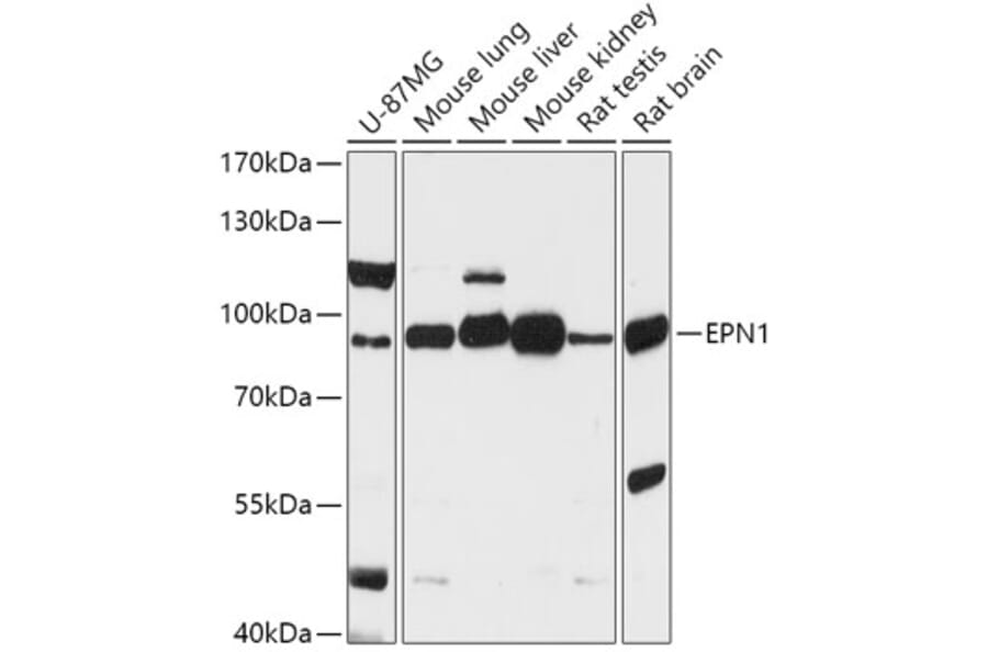 Western Blot - Anti-Epsin 1 Antibody (A306760) - Antibodies.com