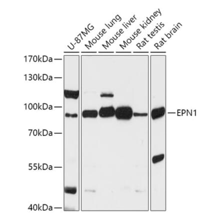 Western Blot - Anti-Epsin 1 Antibody (A306760) - Antibodies.com