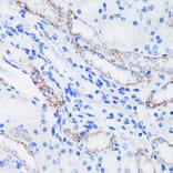 Immunohistochemistry - Anti-Epsin 1 Antibody (A306760) - Antibodies.com