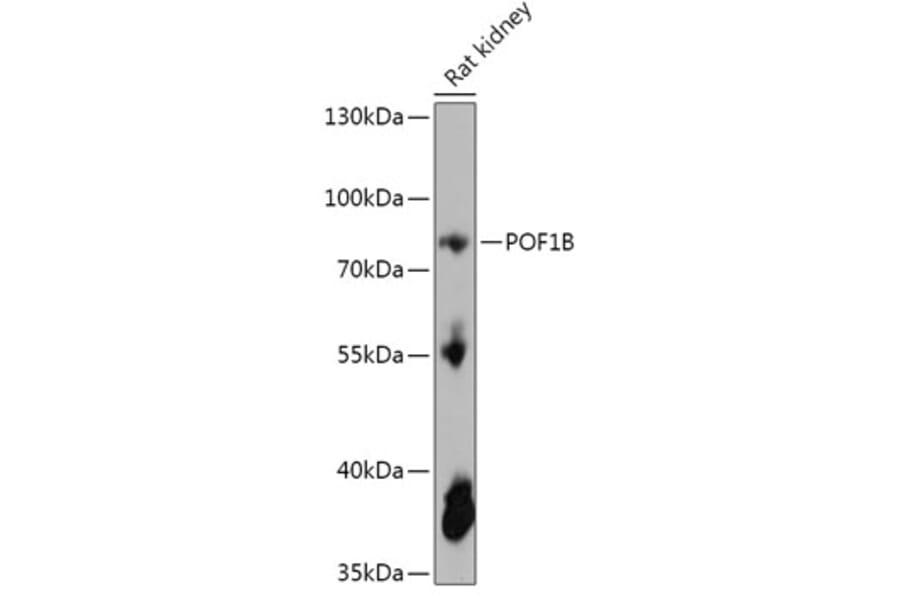 Western Blot - Anti-POF1B Antibody (A306762) - Antibodies.com