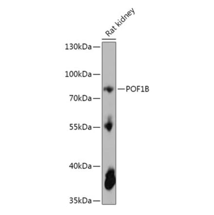 Western Blot - Anti-POF1B Antibody (A306762) - Antibodies.com