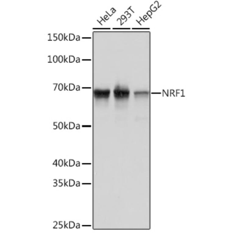 Western Blot - Anti-NRF1 Antibody [ARC0768] (A306763) - Antibodies.com