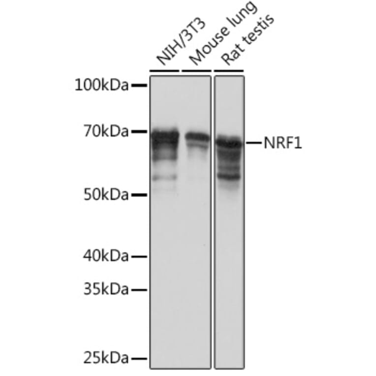 Western Blot - Anti-NRF1 Antibody [ARC0768] (A306763) - Antibodies.com