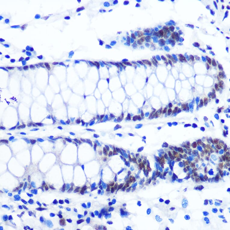 Immunohistochemistry - Anti-NRF1 Antibody [ARC0768] (A306763) - Antibodies.com