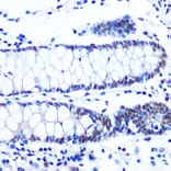 Immunohistochemistry - Anti-NRF1 Antibody [ARC0768] (A306763) - Antibodies.com