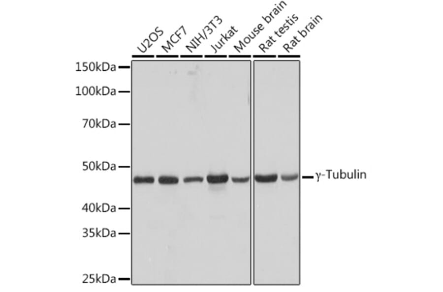 Western Blot - Anti-gamma Tubulin Antibody [ARC1684] (A306765) - Antibodies.com