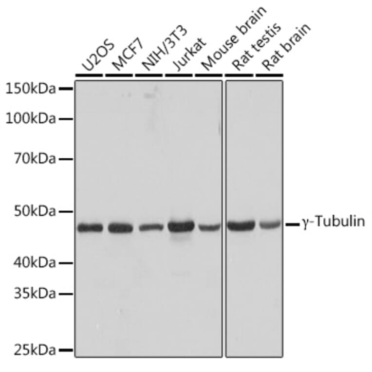 Western Blot - Anti-gamma Tubulin Antibody [ARC1684] (A306765) - Antibodies.com