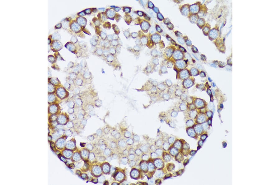 Immunohistochemistry - Anti-gamma Tubulin Antibody [ARC1684] (A306765) - Antibodies.com