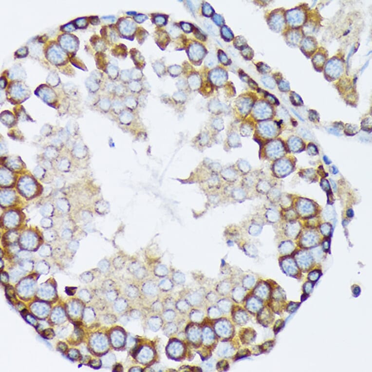 Immunohistochemistry - Anti-gamma Tubulin Antibody [ARC1684] (A306765) - Antibodies.com