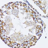 Immunohistochemistry - Anti-gamma Tubulin Antibody [ARC1684] (A306765) - Antibodies.com