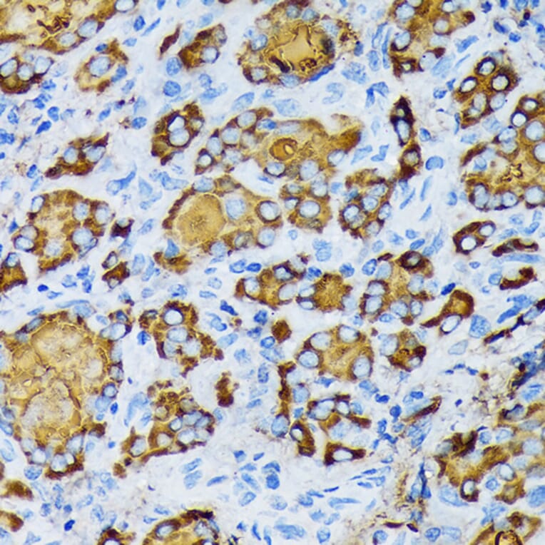 Immunohistochemistry - Anti-gamma Tubulin Antibody [ARC1684] (A306765) - Antibodies.com