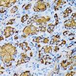 Immunohistochemistry - Anti-gamma Tubulin Antibody [ARC1684] (A306765) - Antibodies.com