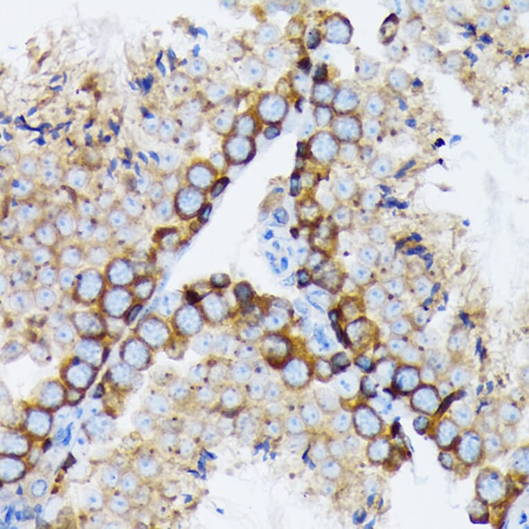 Immunohistochemistry - Anti-gamma Tubulin Antibody [ARC1684] (A306765) - Antibodies.com