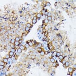 Immunohistochemistry - Anti-gamma Tubulin Antibody [ARC1684] (A306765) - Antibodies.com