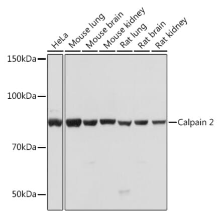 Western Blot - Anti-Calpain 2 Antibody [ARC0891] (A306767) - Antibodies.com