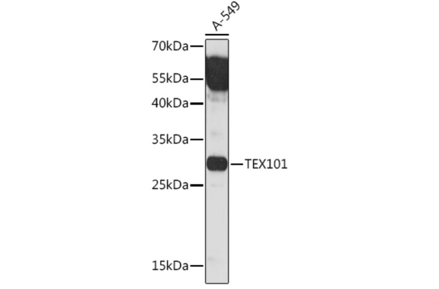 Western Blot - Anti-TEX101 Antibody (A306768) - Antibodies.com