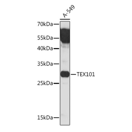 Western Blot - Anti-TEX101 Antibody (A306768) - Antibodies.com