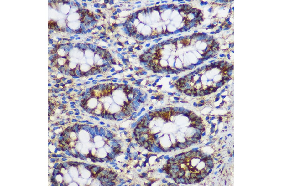 Immunohistochemistry - Anti-TEX101 Antibody (A306768) - Antibodies.com