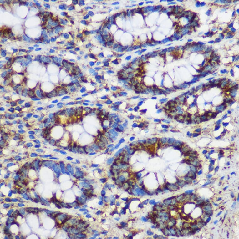 Immunohistochemistry - Anti-TEX101 Antibody (A306768) - Antibodies.com