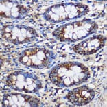 Immunohistochemistry - Anti-TEX101 Antibody (A306768) - Antibodies.com