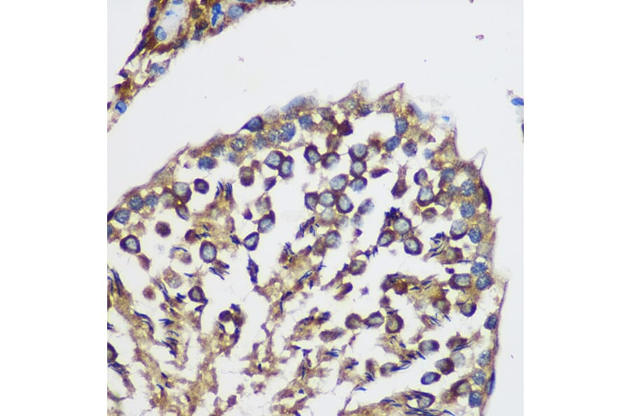 Immunohistochemistry - Anti-TEX101 Antibody (A306768) - Antibodies.com