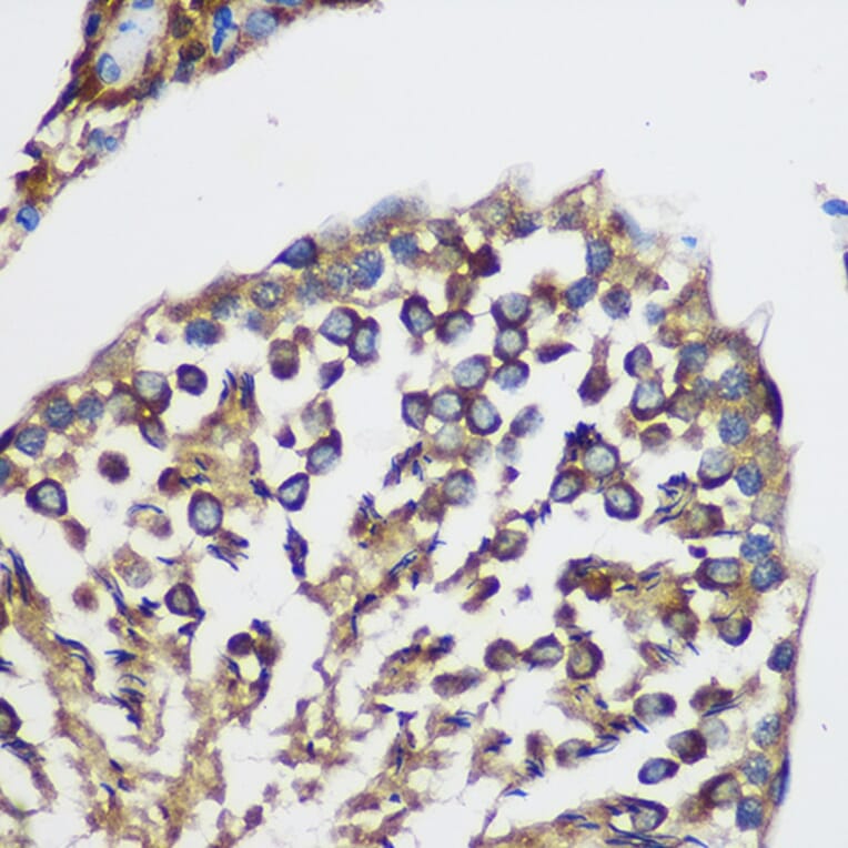 Immunohistochemistry - Anti-TEX101 Antibody (A306768) - Antibodies.com