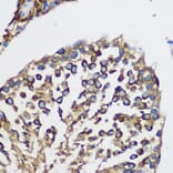 Immunohistochemistry - Anti-TEX101 Antibody (A306768) - Antibodies.com