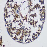 Immunohistochemistry - Anti-TEX101 Antibody (A306768) - Antibodies.com