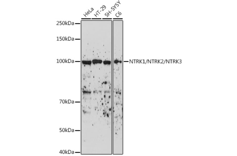 Western Blot - Anti-TrkA + TrkB + TrkC Antibody (A306771) - Antibodies.com