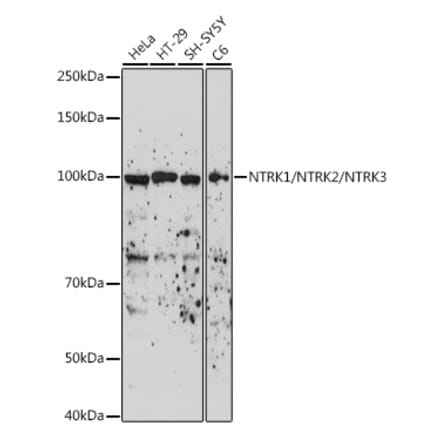 Western Blot - Anti-TrkA + TrkB + TrkC Antibody (A306771) - Antibodies.com
