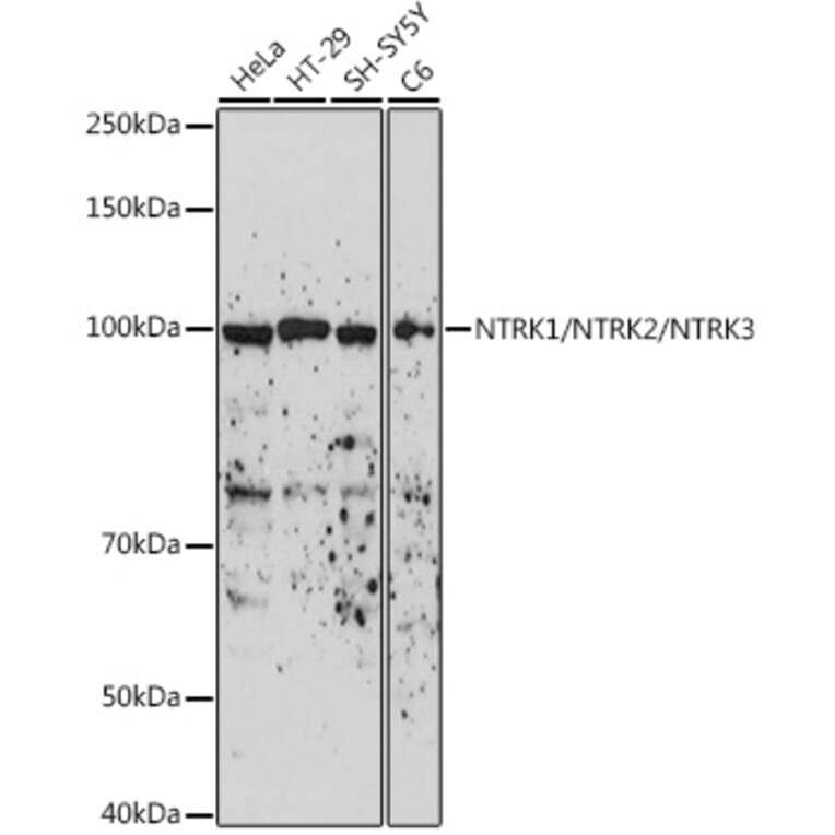 Western Blot - Anti-TrkA + TrkB + TrkC Antibody (A306771) - Antibodies.com