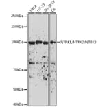 Western Blot - Anti-TrkA + TrkB + TrkC Antibody (A306771) - Antibodies.com