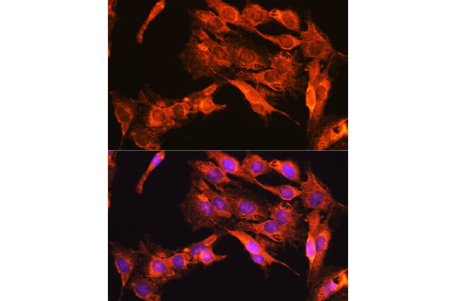 Immunofluorescence - Anti-TrkA + TrkB + TrkC Antibody (A306771) - Antibodies.com